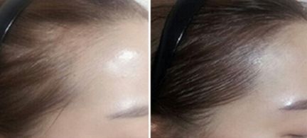 鄭州芳藝醫(yī)療整形醫(yī)院有沒有特色項(xiàng)目？如何一鍵獲取？
