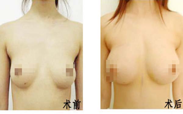 遂寧伊莎貝拉醫(yī)學(xué)美容門(mén)診部醫(yī)生是否值得信賴？他們的專(zhuān)業(yè)素質(zhì)如何？