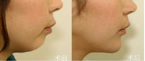 北京市前十名正頜醫(yī)院推薦：八處，協(xié)和，聯(lián)合麗格等，專業(yè)可靠！