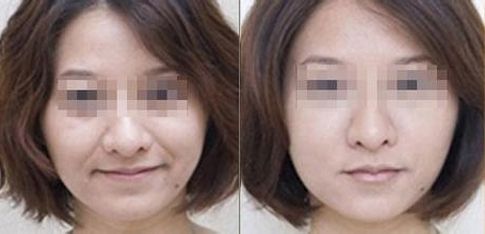 成都有哪些專業(yè)的雙眼皮整形醫(yī)生值得推薦？