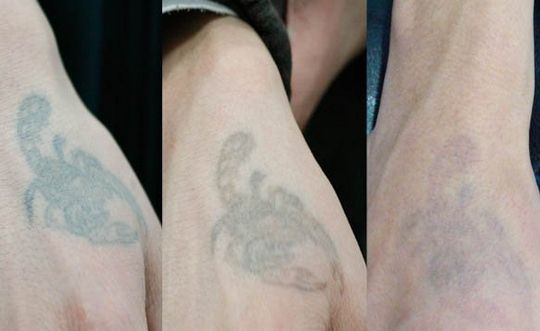 長沙哪家整形醫(yī)院技術(shù)靠譜？私立醫(yī)美還可信嗎？