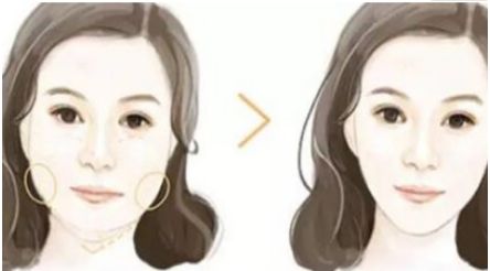 成都哪家口碑整形醫(yī)院好？傾情推薦三家實力不凡的醫(yī)療機構(gòu)