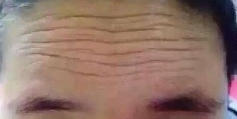 北京整形美容領域醫(yī)院推薦！最受好評的隆鼻醫(yī)院新版名單發(fā)布！