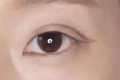 上海九院植發(fā)醫(yī)生劉清簡介，用心解讀醫(yī)生信息！總結(jié)速查：上海九院植發(fā)醫(yī)師劉清，醫(yī)術(shù)高超！