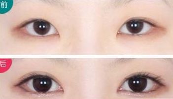 全國頂級整形醫(yī)院奉上前十年度最佳隆胸選擇！專業(yè)可靠服務(wù)，平價優(yōu)惠！