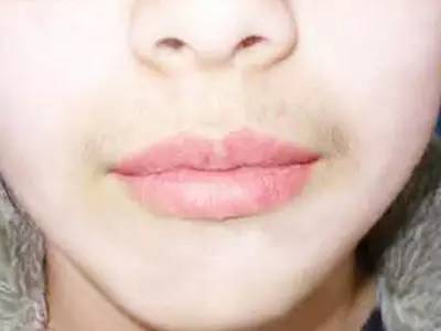 無錫三院整形科哪位醫(yī)生會更受關(guān)注？