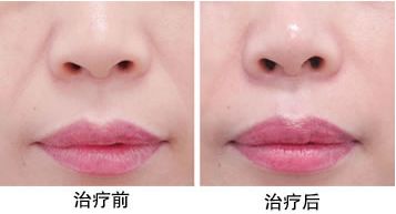 最靠譜的蘇州下頜角整形醫(yī)院推薦，口碑爆棚的醫(yī)療機構(gòu)評選