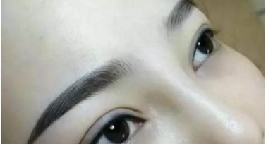 北京哪個醫(yī)院治療胎記效果好？這家醫(yī)院備受推崇
