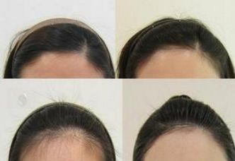 上海久愿整形醫(yī)院:醫(yī)術(shù)高超的專家團隊及服務(wù)費用展示 上海久愿整形醫(yī)院:醫(yī)術(shù)高超的專家團隊及服務(wù)費用展示