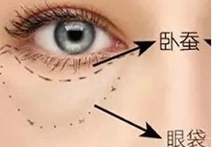 北京協(xié)和醫(yī)院隆胸案例與醫(yī)生簡(jiǎn)介含金量如何？收費(fèi)是否合理？