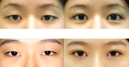 上海五位頂級整形專家鼻王盤點，你無法想象的專業(yè)能力，只有你才知道的顛覆美麗！