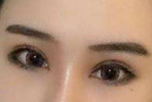 成都大華整形醫(yī)院醫(yī)生有哪些擅長項目？醫(yī)院技術如何？
