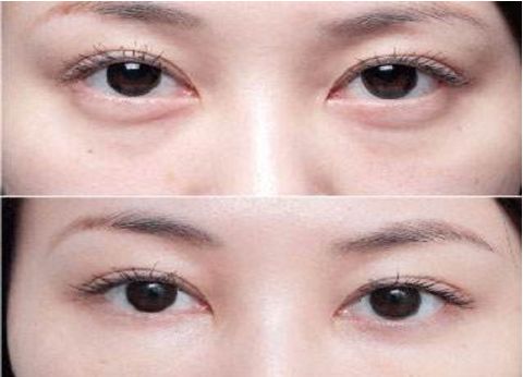 杭州專業(yè)整容醫(yī)療機(jī)構(gòu)排行榜大揭秘！藝術(shù)之星醫(yī)療集團(tuán)對(duì)比時(shí)光整形大賽！真實(shí)原因還原無(wú)遺！