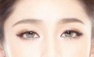 石家莊美聯(lián)臣雙眼皮整形靠譜嗎？有哪些優(yōu)秀醫(yī)生？有什么成功案例供參考？
