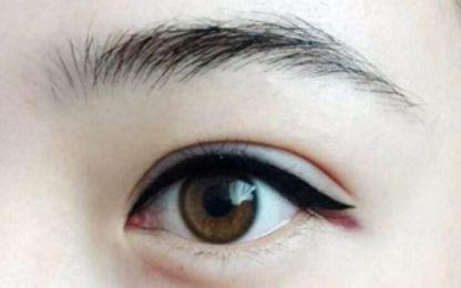 南寧醫(yī)科大雙眼皮整形費用及技術(shù)綜述！名單與收費指南分享