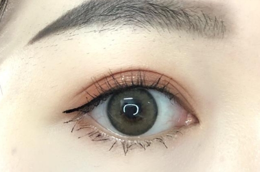 葉秀娣吸脂效果如何？值得一試嗎？