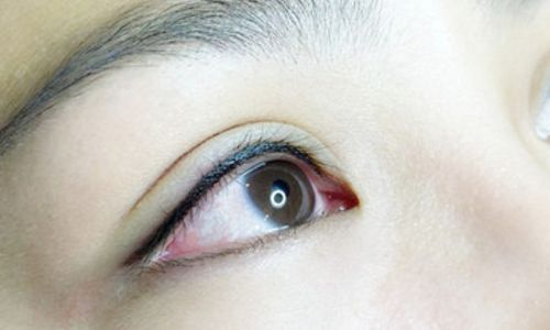 劉中國醫(yī)生成都潤美玉之光整形醫(yī)院的口碑是否好？大腿吸脂術(shù)效果如何呢？