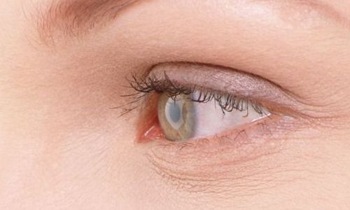 航空院眼袋手術(shù)效果如何？最新案例分享