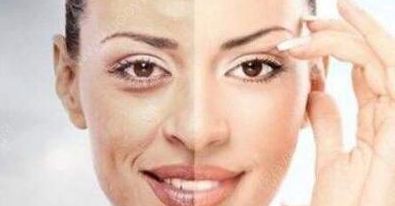 成都賈德淵醫(yī)生的眼睛技術有何不同？80天變化詳解