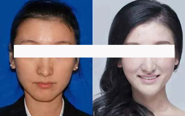 寧波藝星整形和珈禾整形，哪家更具實力？醫(yī)生口碑、項目擅長和地址公布等方面的對比如何？
