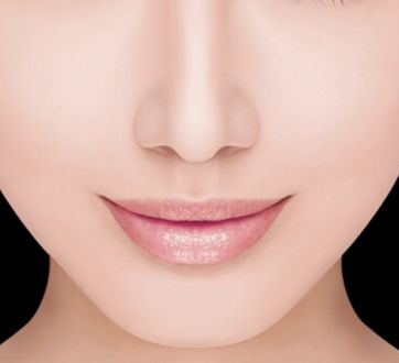 哈醫(yī)大四院李巍主治醫(yī)生鼻整形手術(shù)！80天重塑完美鼻型全記錄！