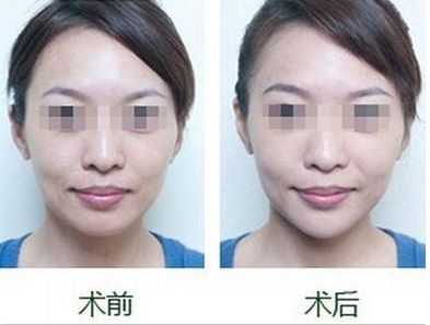 首屈一指的醫(yī)院！揭秘北京植發(fā)領(lǐng)域排名靠前的頂級機(jī)構(gòu)