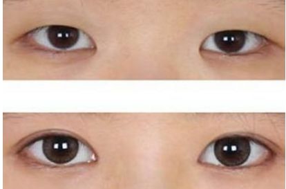 選擇合適的武漢植發(fā)醫(yī)院，看看專家排名和推薦