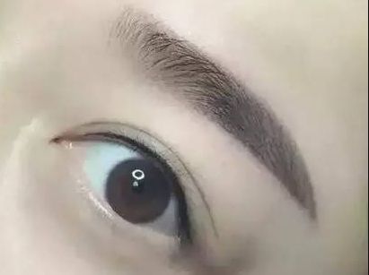 護(hù)眼實(shí)踐：林琦東如何改善視力？真實(shí)案例揭示眼部整形費(fèi)用