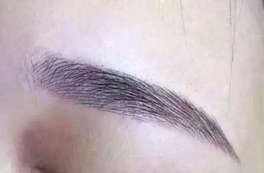 長(zhǎng)沙脂肪吸取專家揭秘：技術(shù)卓越，無數(shù)口碑背后的醫(yī)美奇跡！