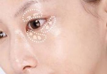 吳毅平醫(yī)生坐診醫(yī)院及隆胸案例分享，詳細介紹！