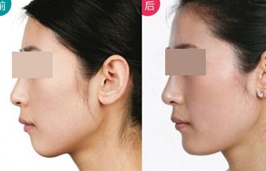 上海哪個(gè)醫(yī)生擅長(zhǎng)鼻翼縮小？2023年度網(wǎng)民口碑推薦醫(yī)生名冊(cè)曝光