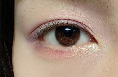 貴陽市激光脫毛服務(wù)品牌推薦