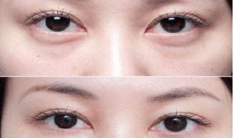 成都眼部整形醫(yī)生高分榜單發(fā)布！這些醫(yī)生哪家強(qiáng)？附詳細(xì)醫(yī)生信息