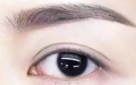 全國哪位專家值得信賴修復(fù)雙眼皮手術(shù)？頂級醫(yī)生排行榜首推名單揭曉