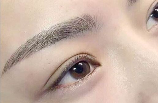 眼袋手術(shù)費(fèi)用及醫(yī)生評(píng)價(jià)與項(xiàng)目分析？