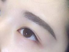 李炳澮醫(yī)生獨特的技術(shù) 手術(shù)風(fēng)格有何特點？并附帶隆鼻案例分析