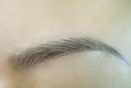 上海九院墊下巴誰的技術(shù)好？魏皎醫(yī)生真人案例和價格均價對比可信嗎？