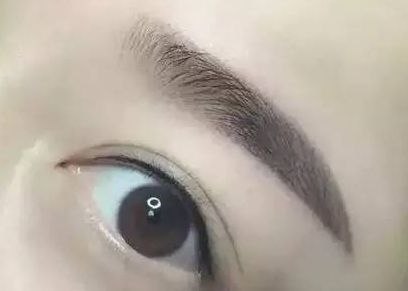 醫(yī)生楊明勇：從技術(shù)實力到用戶評價揭秘，提眉案例評價出乎預(yù)料！