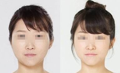 廣州哪家醫(yī)院能夠有效除皺？詳細介紹醫(yī)院基本情況分享