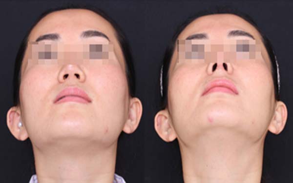 淄博麗人醫(yī)院整形美容科靠譜嗎？有口碑醫(yī)生推薦嗎？