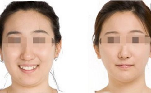 鄭州哪位醫(yī)生在鼻整形領(lǐng)域赫赫有名？口碑出類拔萃的五位專家揭曉！
