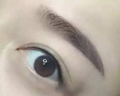 廈門哪家整形醫(yī)院口碑好？專家推薦薇格、中山前三！