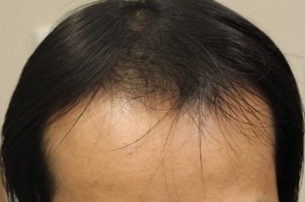 捷康醫(yī)療美容門診部的醫(yī)生實(shí)力如何？術(shù)前評(píng)估到位嗎？術(shù)后效果滿意嗎？