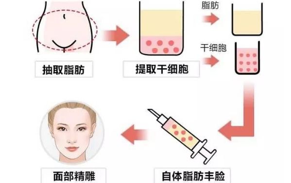 從醫(yī)生個(gè)人資料到豐胸案例圖對(duì)比，揭秘王沛森的豐胸效果！