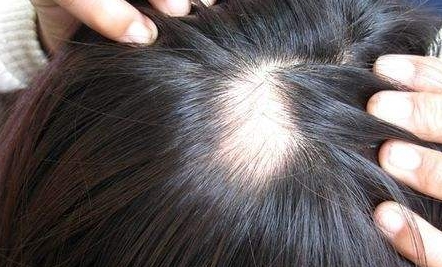 徐州眉弓填充哪家醫(yī)美機構(gòu)效果好？