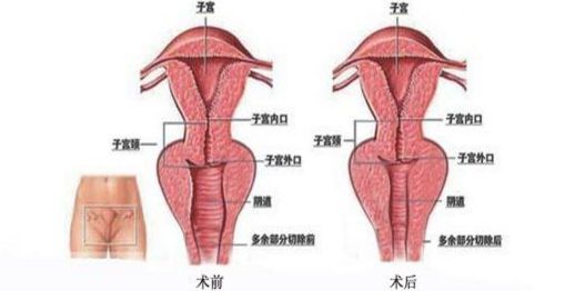 上海九院哪里能夠得到專業(yè)的隆鼻手術(shù)？排行榜最新推薦五位頂尖隆鼻專家