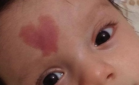 深圳天愛整形醫(yī)院好不好？技術牛不牛？醫(yī)生口碑怎么樣？擅長的項目價格如何公布？