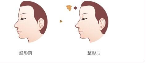 綿陽碧蓮盛植發(fā)醫(yī)院的效果如何？如何查詢地址及醫(yī)生信息？