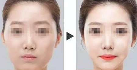 石家莊最受歡迎的除皺美容醫(yī)院排名榜前六來(lái)襲！2023年超贊抗衰除皺全攻略！