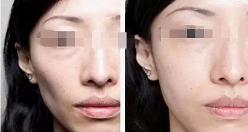 廈門整容醫(yī)院實(shí)力排名揭曉，輕松擁有美麗容顏！
